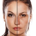 آبرسان یا مرطوب کننده پوست؛ کدامیک؟