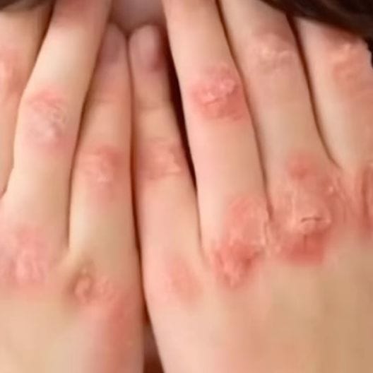 مراقبت از پوست و بررسی مشکلات پوستی